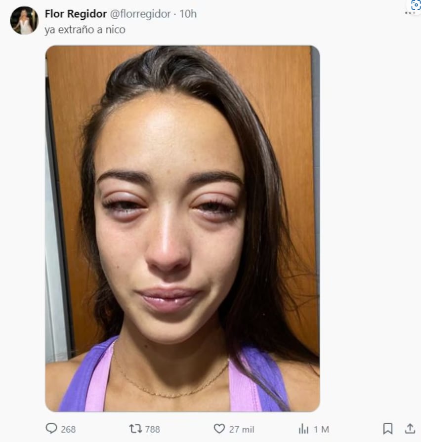 El posteo de Flor Regidor que generó preocupación en los fans.