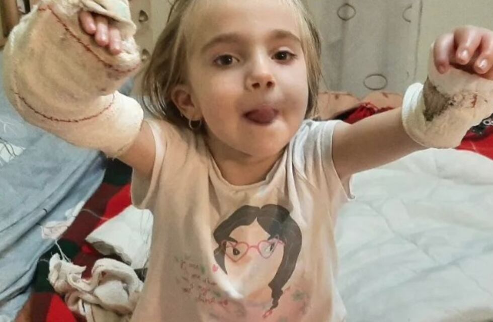 Videos: mirá la evolución y alegría de Juanita, la guerrera mendocina que fue operada en Barcelona por una malformación