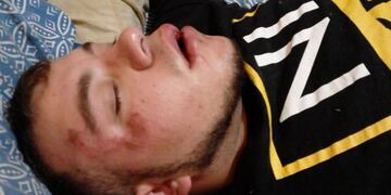 Axel fue asaltado, golpeado y abandonado en la vía pública. Su familia asegura que la Policía también hizo "abandono de persona".