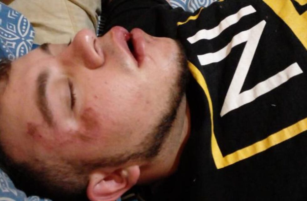 Inseguridad en Córdoba: lo golpearon para asaltarlo y lo dejaron tirado en la calle