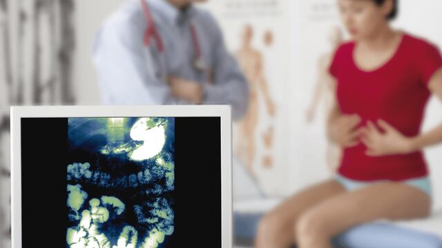 El cáncer de colon es el tumor más frecuente del aparato digestivo y ocupa el tercer lugar en ambos sexos. (Sanatorio Allende)