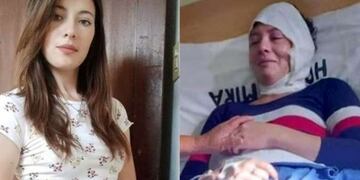 Su ex la citó para pagarle la cuota alimentaria y la quemó con aceite hirviendo