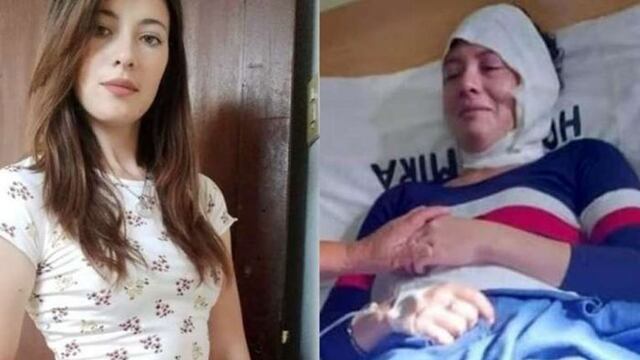 Su ex la citó para pagarle la cuota alimentaria y la quemó con aceite hirviendo