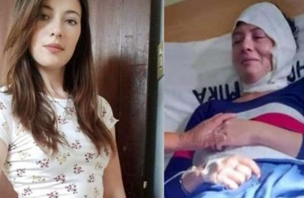 Viale: su expareja la citó para pagarle la cuota alimentaria y la atacó con aceite hirviendo