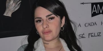 La cordobesa mostró cómo quedó después de un procedimiento estético.