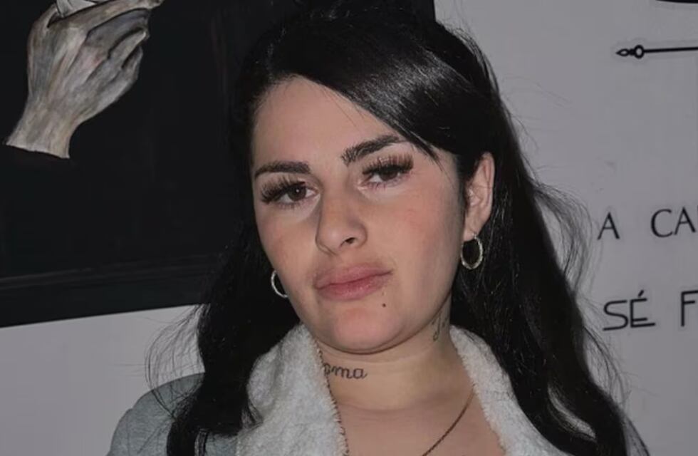 Kami Franco se sometió a un nuevo procedimiento estético y mostró el antes y después