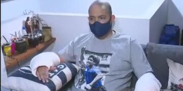 Juan, el hombre atacado por un pitbull.