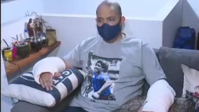 Juan, el hombre atacado por un pitbull.