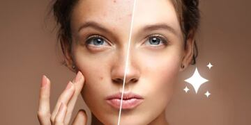 Los peligros de Bold Glamour, el nuevo filtro de TikTok: puede ocasionar dismorfia corporal.