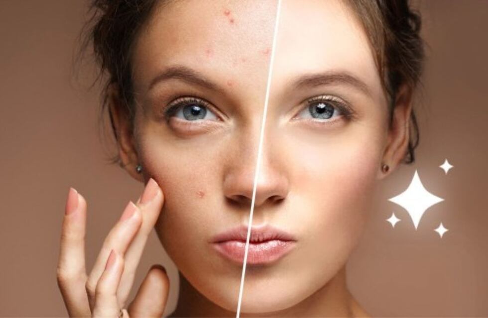 Los peligros de “Bold Glamour”, el nuevo filtro de TikTok: puede ocasionar dismorfia corporal