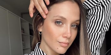 El descuido estético de Barbie Vélez que terminó en un problema de salud: “Fue una mala idea”.