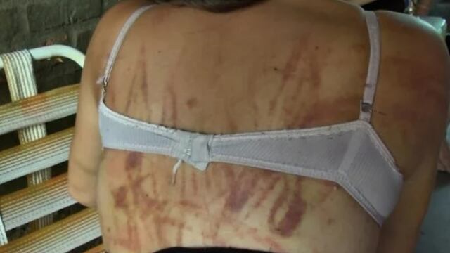 Ante las declaraciones de la madre del violento, los vestigios en el cuerpo de la víctima dan cuenta de la saña y la atrocidad de los golpes.