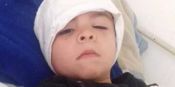 Sebastián logró sobrevivir a pesar de los diagnósticos poco favorables luego del ataque.