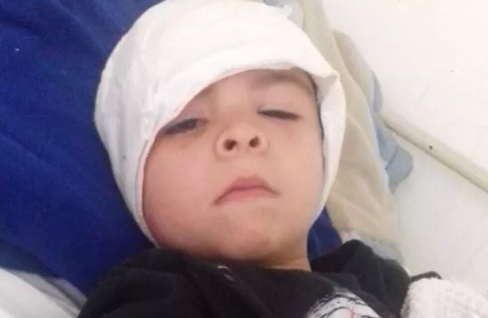 El niño macheteado por su vecino en Iguazú hace dos años, recibió una prótesis en Posadas