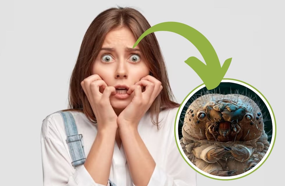 Esta es la criatura que vive en tus cejas y seguro no lo sabías