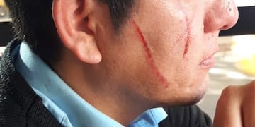 El chofer terminó con toda la cara rasguñada.