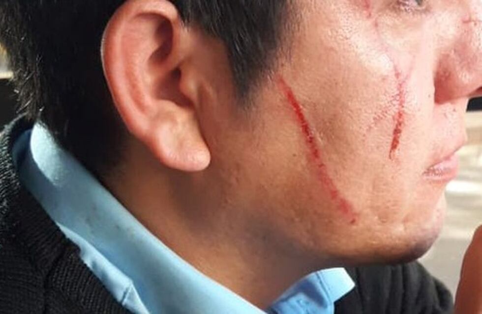 Violencia en Córdoba: brutal pelea entre un chofer del transporte urbano y una pasajera