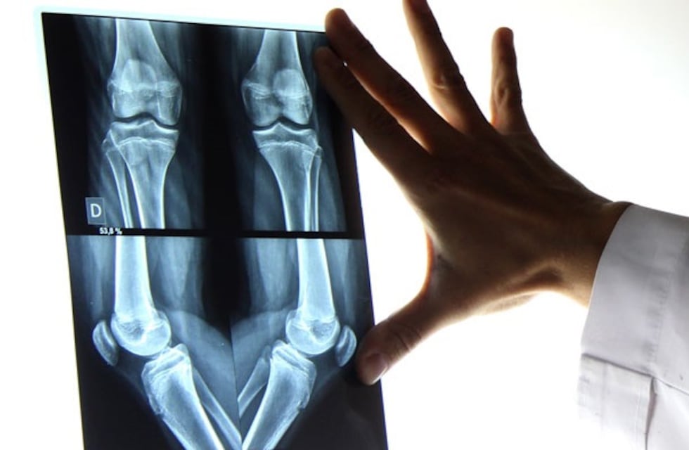 El divertido audio de un médico mendocino se hizo viral en TikTok: “No es un deporte para gordos”