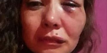 La víctima sufrió traumatismos en ambas rodillas, espalda, pecho, un cefalohematoma occipital y hematoma periorbital en el ojo izquierdo.