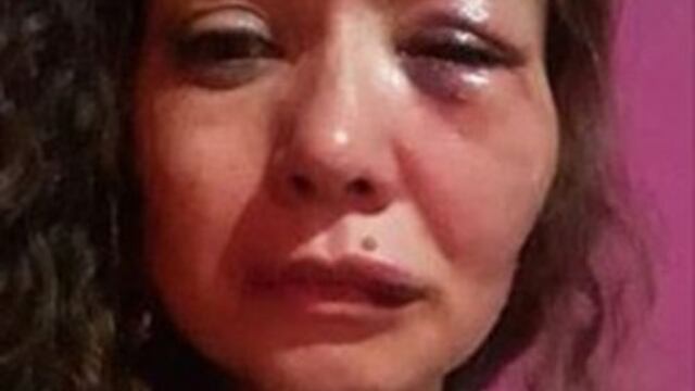 La víctima sufrió traumatismos en ambas rodillas, espalda, pecho, un cefalohematoma occipital y hematoma periorbital en el ojo izquierdo.