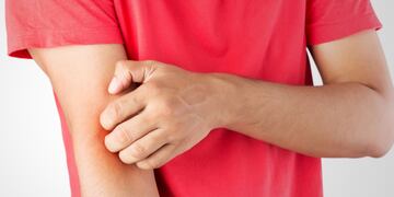 Qué es y cuáles son los síntomas de la enfermedad de Lyme, según Mayo Clinic