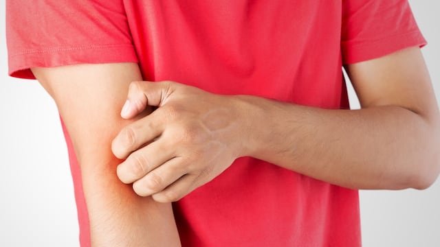 Qué es y cuáles son los síntomas de la enfermedad de Lyme, según Mayo Clinic