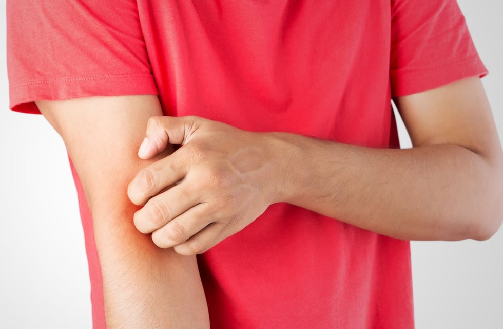 Qué es y cuáles son los síntomas de la enfermedad de Lyme, según Mayo Clinic