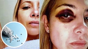 Así es el tratamiento con árnica que recibió Fabiola Yañez, recomendado por el médico de Alberto Fernández.