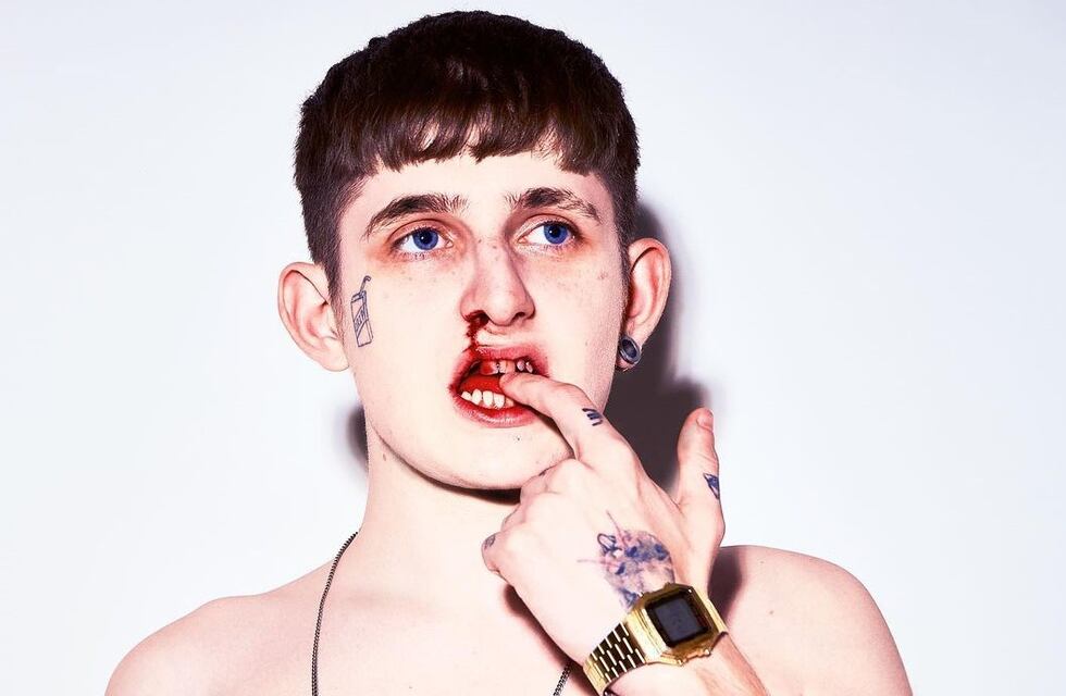 El llamativo posteo de Dillom al salir del quirófano: “Me operé el tabique para respirar bien, nada estético”