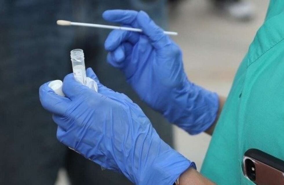 La ANMAT autorizó la venta libre en farmacias de un test de COVID-19 rápido y económico