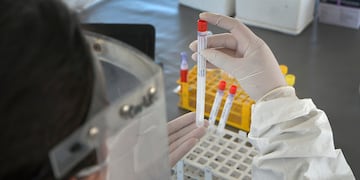 Coronavirus en Tandil: falleció un hombre de 81 años