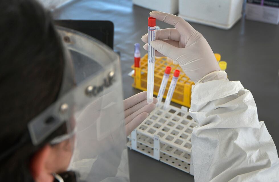 Coronavirus en Mendoza: solo el 1.5% de las muestras procesadas dio positivo
