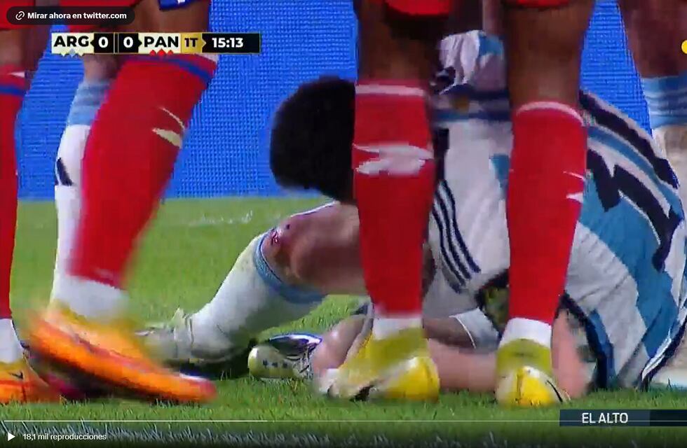 Video: la impresionante imagen de la rodilla de Messi tras una patada que le dio un jugador de Panamá