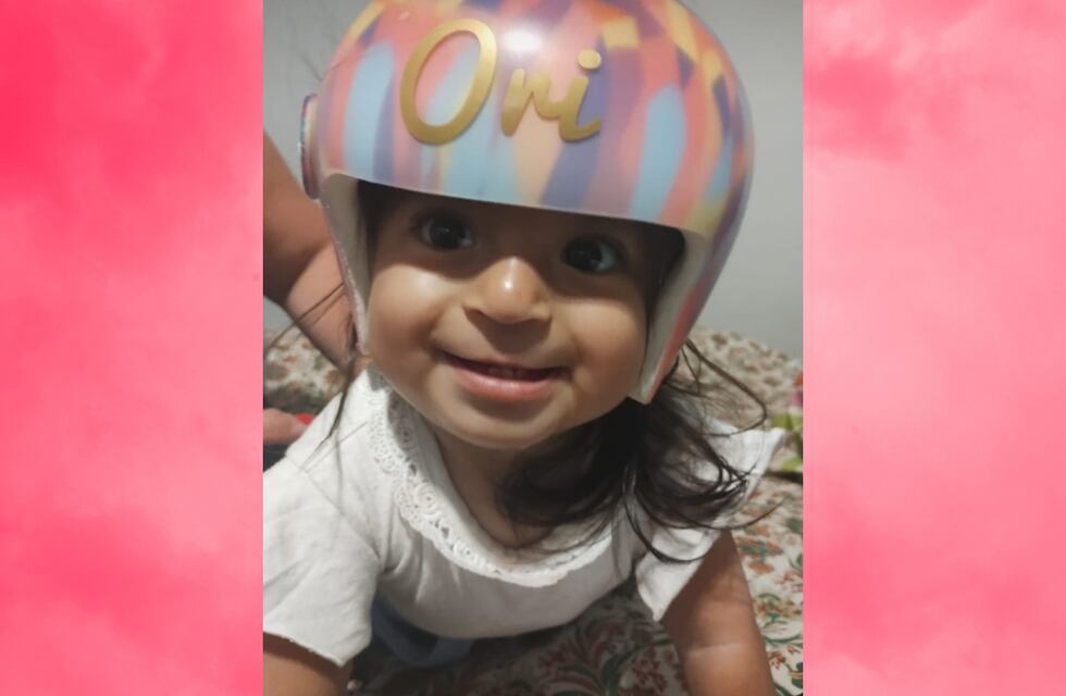Gracias a la solidaridad de San Luis, Oriana ya tiene su órtesis craneal
