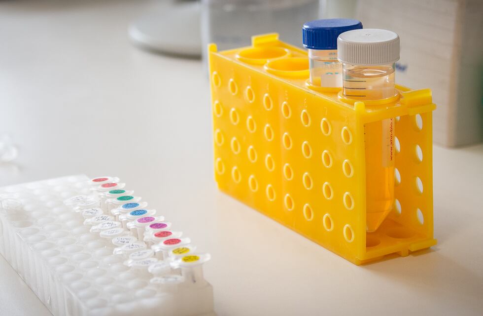 Detectaron la circulación de una cepa invasiva de la bacteria Chlamydia trachomatis en un paciente cordobés