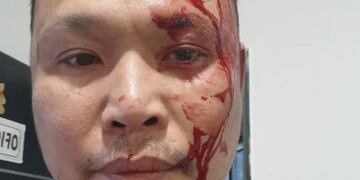 terminó con enfrentamientos y personas heridas