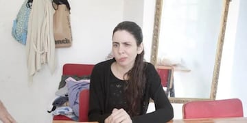 Daiana Velovich, la neuquina de 33 años que necesita operarse de urgencias para no perder la visión.