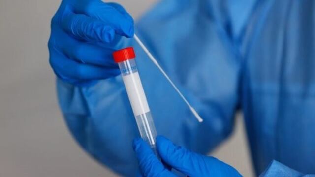 Este miércoles el centro de testeo de Covid-19 de Jardín América permanecerá cerrado por fumigación.