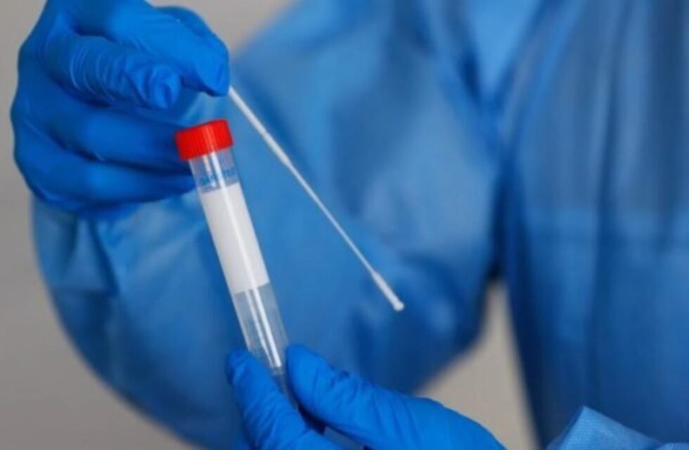 Pérez: 63 nuevos contagios por Covid-19