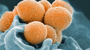 BACTERIA.  Streptococcus del Grupo A, en una imagen ilustrativa (National Institute of Allergy and Infectious Diseases vía AP).