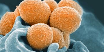 BACTERIA.  Streptococcus del Grupo A, en una imagen ilustrativa (National Institute of Allergy and Infectious Diseases vía AP).