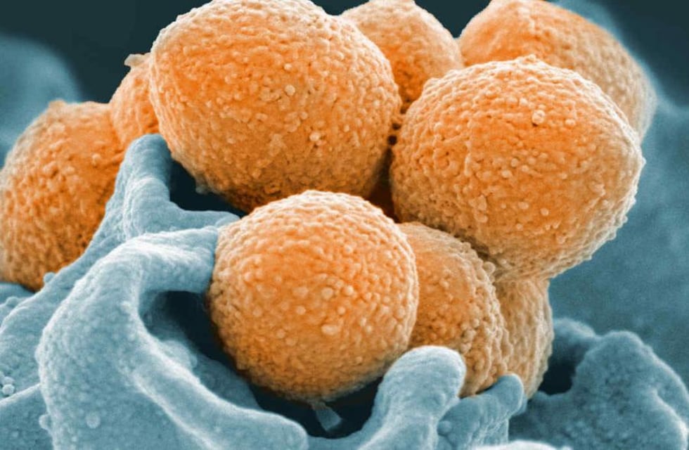 Qué es el streptococcus pyogenes y por qué empieza a preocupar en Argentina