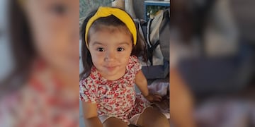 Emilia, la pequeña niña mendocina que padece de una extraña enfermedad y necesita una operación que le salve la vida.