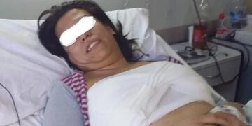 Eliana Romero, la sanjuanina trans de 35 que denuncia desatención en el hospital tras realizarse un implante mamario.