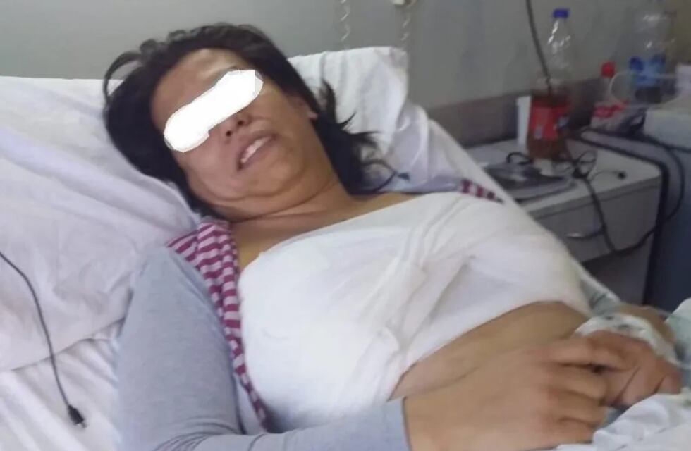 Desde el hospital Rawson respondieron a la mujer trans que los denunció por desatención tras realizarse implantes mamarios