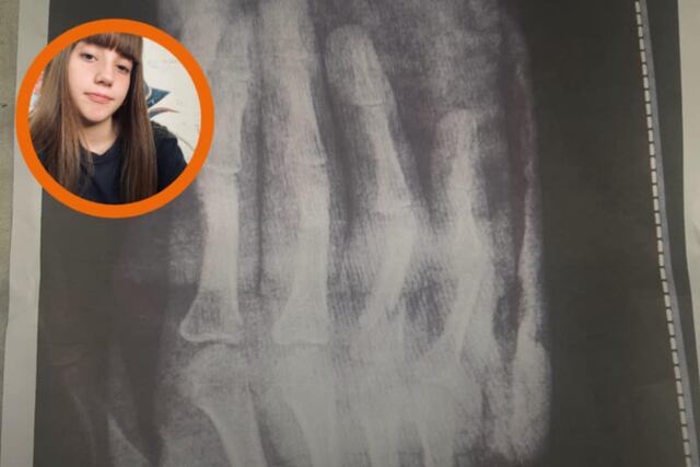 Puntaltense necesita con urgencia operarse de la mano y debe juntar más de 3 millones