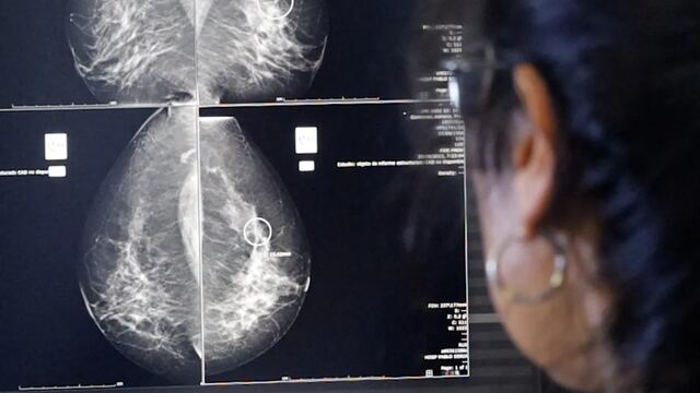 Con la cobertura del Programa de Control de Cáncer de Mama, en el último año se incrementó un 50% la cantidad de mamografías realizadas en toda la provincia, llegando a un total de 5.600 estudios solo en el ámbito público.