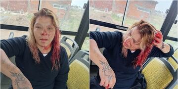 Bahía Blanca: atacaron a una mujer por no invitar  a las chicas del barrio a la fiesta de 15 de su hija