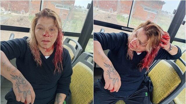 Bahía Blanca: atacaron a una mujer por no invitar  a las chicas del barrio a la fiesta de 15 de su hija