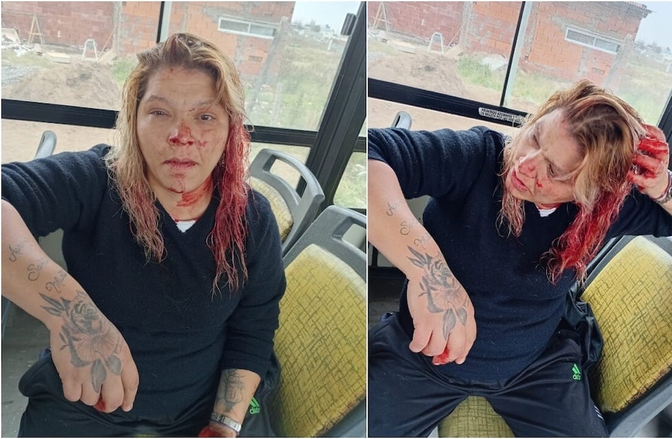 Bahía Blanca: atacaron a una mujer por no invitar  a las chicas del barrio a la fiesta de 15 de su hija